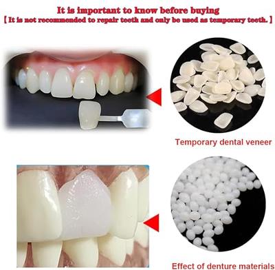 Temporary Tooth Repair Kit for Temporary Fixing Missing and Broken Tooth Moldable Fake Teeth and Thermal Beads Replacement Kit (Size : 1)