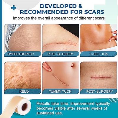 NUVADERMIS Silicone Scar Sheets, Tape, Strips - USA Tested - Healing Keloid