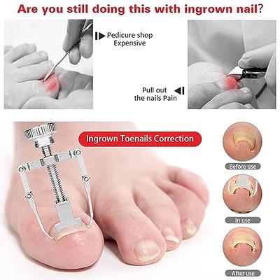 14 Pcs Toenail Clippers for Thick Nails, Ingrown Toenail Clippers