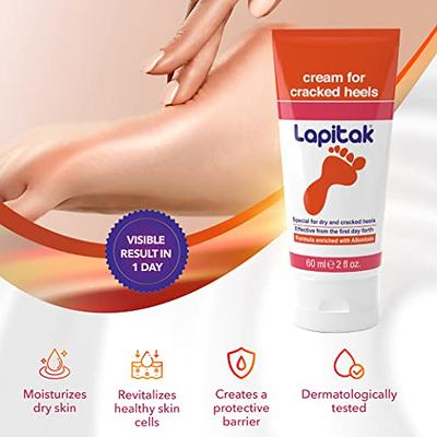 Hand And Foot Peeling Spray 60Ml Callus Dead Skin Removal Spray Foot Heel  Cracked Repair Exfoliating & Moisturizing for Dryness Hand Feet Care 60Ml