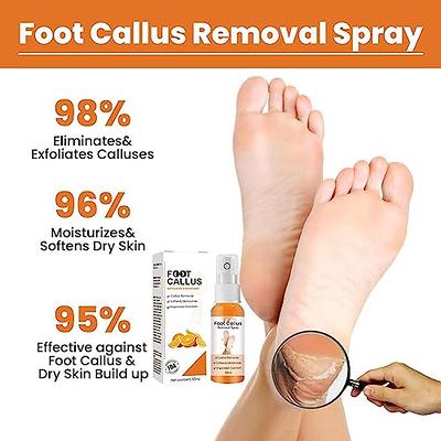 This Callus Eliminator from  Saved My Feet