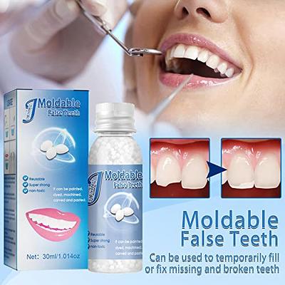 Tooth Repair Bead, Broken Teeth Repair, Multi Functional Temporary Tooth  Repair Kit Moldable Thermal Fitting Beads Dental Tooth Filling Material for