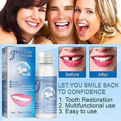 Tooth Repair Kit, Fake Teeth, Moldable False Teeth for Temp Tooth