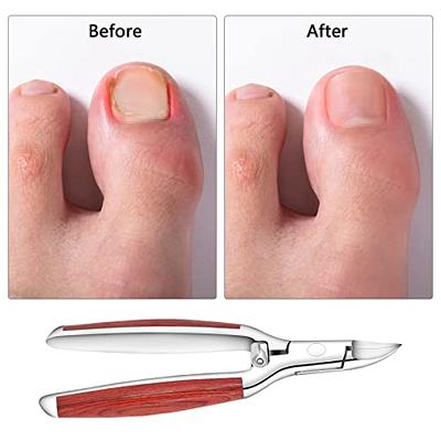 Bezox Toenail Clippers, Nail Clippers for Thick Toenail and Ingrown Nails - Heavy Duty Toenail Nippers, Long Handled Toe Nail Clipper - w/Metal