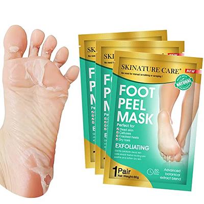 Foot Peel Mask - Exfoliator Peel Off Calluses Dead Skin, Foot Spa and  Callus Remover - Baby Soft Smooth Touch Feet with Lavender and Aloe Vera  for Men and Women (2 Pairs) - Yahoo Shopping