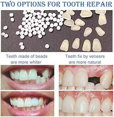 2PCS Temporary Tooth Repair Kit Dental Repair Replace Missing Teeth DIY  Moldable