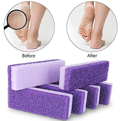 Pumice Stone Foot Scrubber - Pedicure Foot File with Handle for Dry Dead  Skin - Callus Remover for Feet - Foot Scraper - Exfoliating Brush for  Heels, Elbows, Hands - Yahoo Shopping