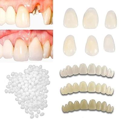 Moldable False Teeth Glue Temporary Filling Teeth, Fix Missing And Broken  Teeth 