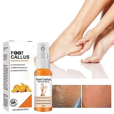 Aghanim Foot Callus Removal Spray - KlariME Foot Peeling Spray, Anti Foot  Callus Removal Spray, Foot Heel Callus Remover Spray, Foot Peeling Spray  Orange Oil, Removes Callus & Cracked Heels (3) - Yahoo Shopping