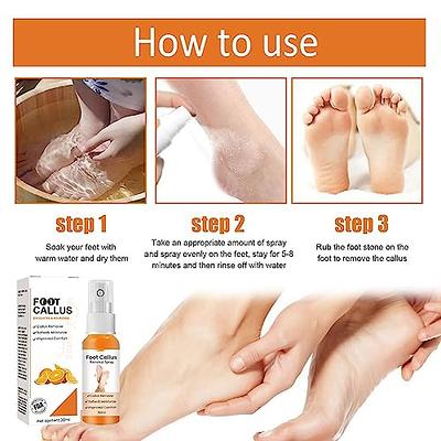 Foot Heel Callus Remover Spray,foot Callus Removal Spray,foot