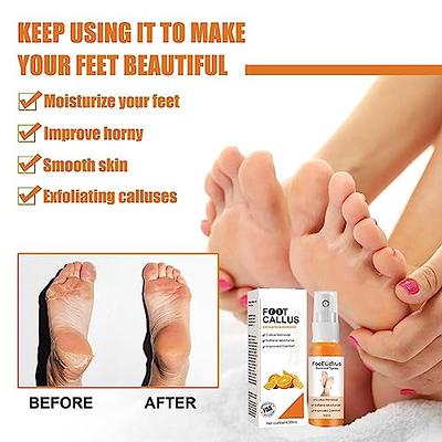 Foot Heel Callus Remover Spray,foot Callus Removal Spray,foot