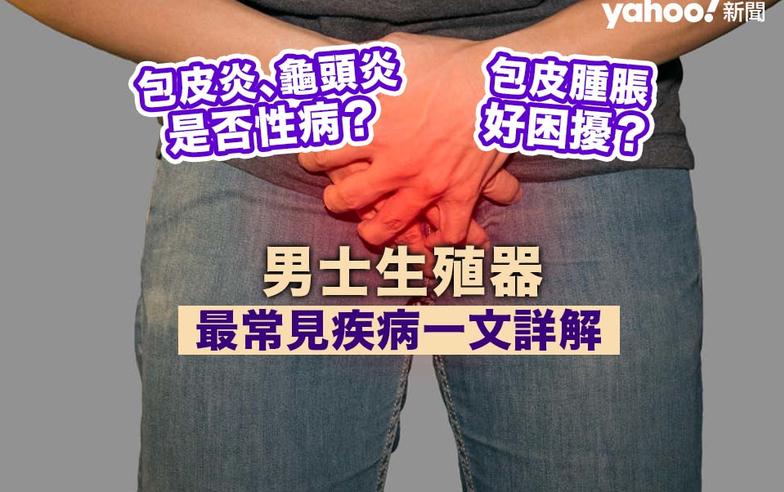 包皮炎、龜頭炎是否性病？包皮腫脹好困擾？男士生殖器最常見疾病一文詳解