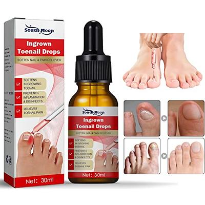 Essential Oils for Nail Fungus : r/Toenail_Fungus