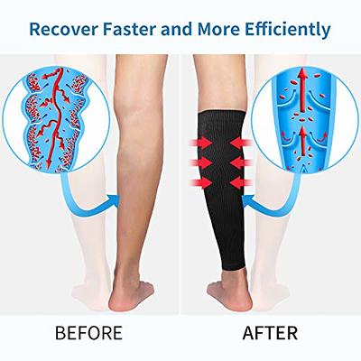 TOFLY® Calf Compression Sleeve for Men & Women, 1 Pair, Footless  Compression Socks 20-30mmHg for Leg Support, Shin Splint, Pain Relief,  Swelling