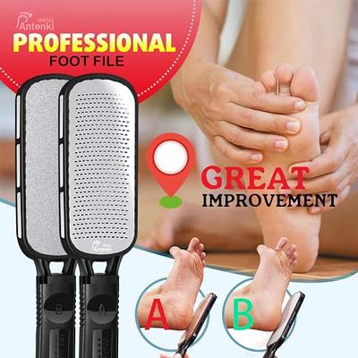 Foot File for Dead Skin, Callus Remover for Feet, Metal Foot Scrubber for  Cracked Heels, Professional