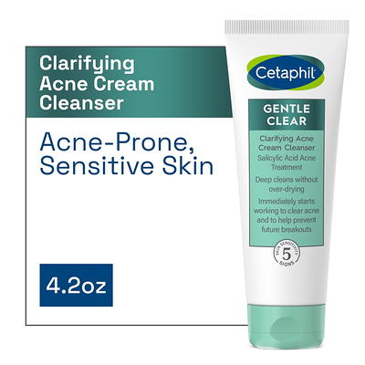 CeraVe Acne Face Wash, Acne Cleanser with Salicylic Acid and Purifying Clay  for Oily Skin, 16 fl oz