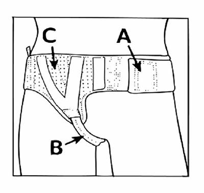 VELPEAU Hernia Belt Truss Adjustable for Single/Double Inguinal