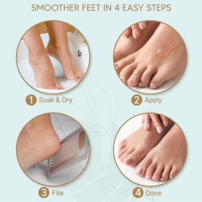 Foot Callus Remover Gel (6oz) - Calloused Feet Remover for Pedicure  Supplies & Kit - Foot Peel Callus Shaver for Feet by Love Lori - Yahoo  Shopping