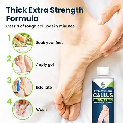 Professional Best Callus Remover Gel for Feet and Foot Pumice Stone  Scrubber Kit Remove Hard Skins Heels and Tough Callouses from feet Quickly  and