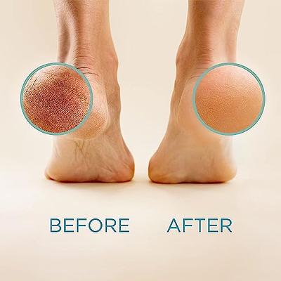 8oz Callus Remover gel for feet for a professional pedicure.