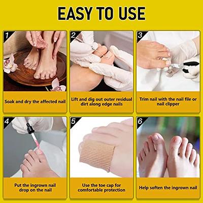 Ingrown Toenail Treatment - Ingrown Toenail Pain Reliever and Softener Kit  for Easy Trimming with Silicone Gel Toe Caps : : Health & Personal  Care