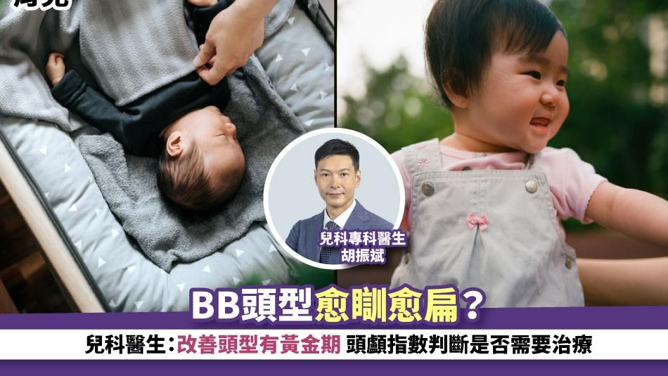 育兒丨BB頭型愈瞓愈扁？兒科醫生：改善頭型有黃金期 頭顱指數判斷是否需要治療