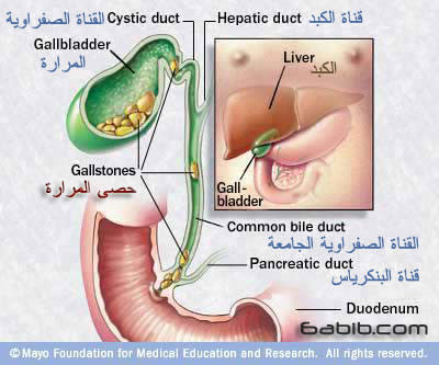 المرارة .. كيف نتقي أمراضها ؟  Gallbladder