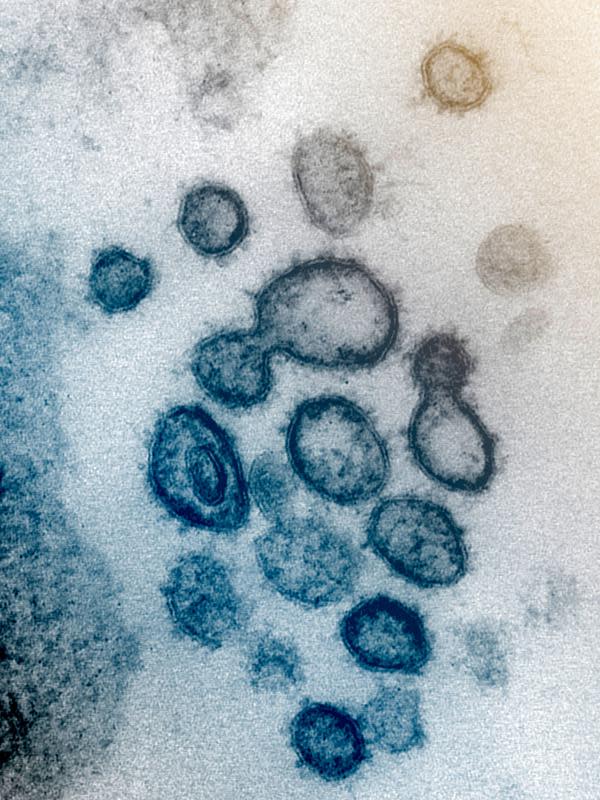 FOTO: Penampakan Virus Corona COVID-19 Dilihat dari Mikroskop