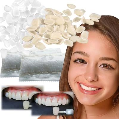 Tooth Repair Kit-Thermal Fitting Beads Granules and Fake Teeth for Temporary  Fixing Missing and Broken Tooth, Moldable Fake Teeth and Thermal Beads  Replacement Kit.【Teeth - Piece Yellow + White】80Pcs - Yahoo Shopping