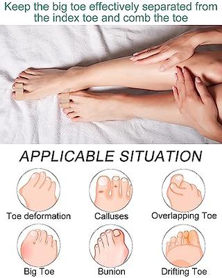 Gel Toe Separators For Overlapping Toe Bunion Corrector Pads For Bunion  Splint Toe Separators With 2 Loops Big Toe Space Suitable For Bunion And  Overlapping Toes Feet Peel One Size A