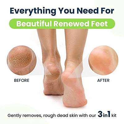 Callus Remover Gel & Pumice Stone Set for Feet & Pedicure