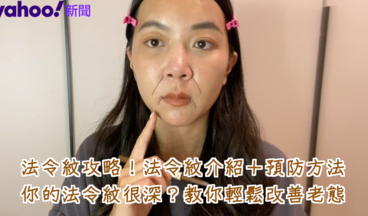 【女生熱話題】避免老態攻略 法令紋介紹+預防方法！