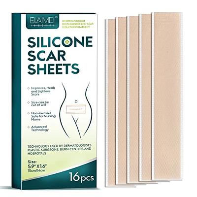 NUVADERMIS Silicone Scar Sheets, Tape, Strips - USA Tested - Healing  Keloid, C-Section, Tummy Tuck - As Surgical Cream, Gel, Patch, Bandage, Pad  - Surgery Scars Treatment - 4 Pack 5.7x1.57 