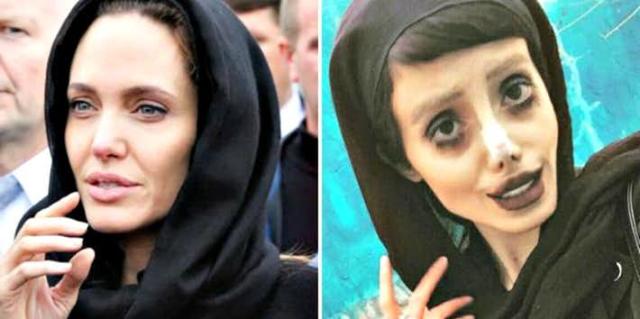 Who Is Sahar Tabar? Before & After Pics Of Teen Who Had 50 Surgeries To Look Like Angelina Jolie 