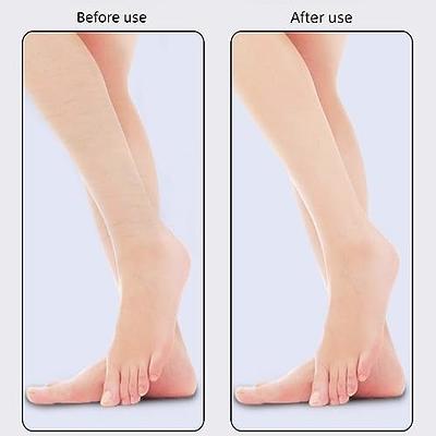 BEZOX Professional Foot File Callus Remover Scraper, Double Sided