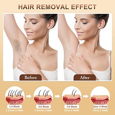  Laser IPL Hair Removal, IPL Hair Removal for Women and