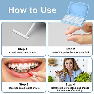 How To Use Wax For Braces
