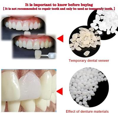 Tooth Repair Beads Granules Temporary Tooth Glue Reusable Moldable False  Teeth