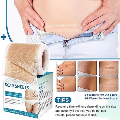 Scar Removal Tape, Scar Silicone Scar Sheets Strips for  C-Section,Surgery,Burn