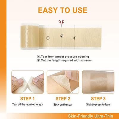 Carbou Silicone Scar Sheets (1.6x 60Roll) Medical Silicone Scar Tape  Roll,Easy-Tear Soft Silicone Tape for Scars Removal,Reusable Painless Silicone  Sheets for Surgery Scars, C-section, Burn, Keloid - Yahoo Shopping
