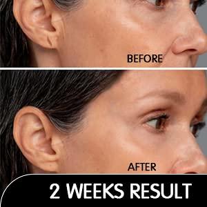 Miracle Stretched earlobe Corrector shrinking oil fix torn and