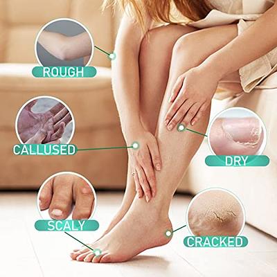 Callus Remover for Women: Best Callus Remover for Women for