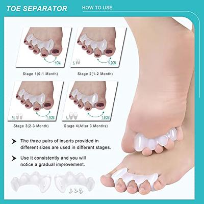 4Pcs 2 Pairs of Gel Toe Separator Silicone Toe Spacers for Correct Toe  Alignment Toe Spreader for Bunions, Restore Overlapping Toes to Original  Shape