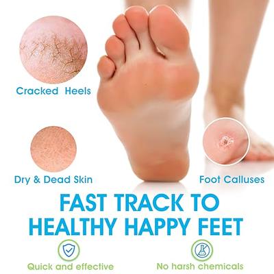  Feet Callus Remover - Instant Exfoliating Peel Foot