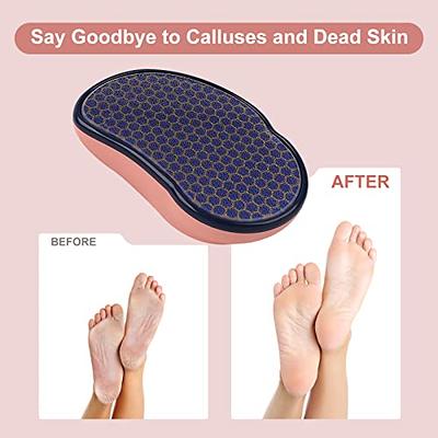 Bare August Glass Foot File Callus Remover- Heel Scraper & in