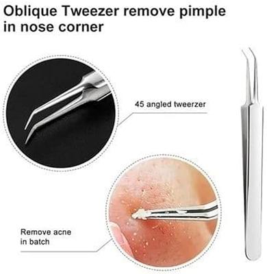 Blackhead Tweezer, Pimple Popper Tool, Clip for Whiteheads, Acne