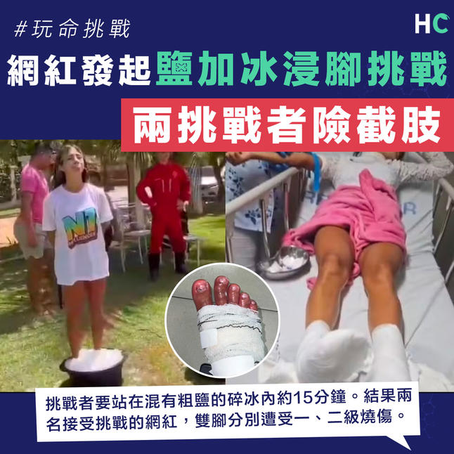 https://hk.news.yahoo.com/%E5%8D%B1%E9%9A%AA%E6%B4%BB%E5%8B%95-%E7%B6%B2%E7%B4%85%E7%99%BC%E8%B5%B7-%E7%B2%97%E9%B9%BD%E5%8A%A0%E5%86%B0%E6%B5%B8%E8%85%B3-%E6%8C%91%E6%88%B0-%E9%87%80%E6%8C%91%E6%88%B0%E8%80%85%E9%9B%99%E8%85%B3%E7%87%92%E5%82%B7%E9%9A%AA%E6%88%AA%E8%82%A2-080000746.html