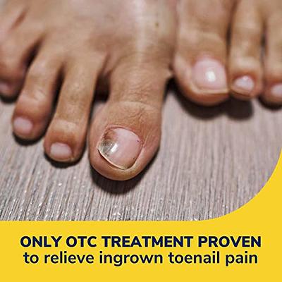 Ingrown toenails: digging out the facts - BPJ65 December 2014