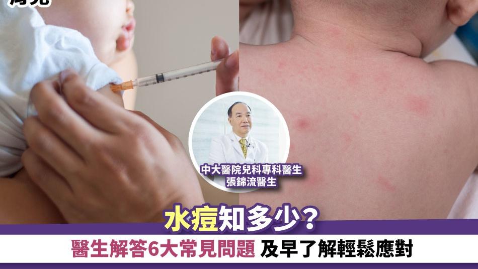 育兒丨水痘知多少？醫生解答6大常見問題 及早了解輕鬆應對