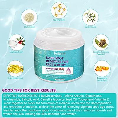 Dark Spot Remover for Face and Body, Dark Spot Corrector for Face, Sun  Spots Melasma Cream and Freckle Remover- Formulated with Arbutin,  Niacinamide & Vitamin E